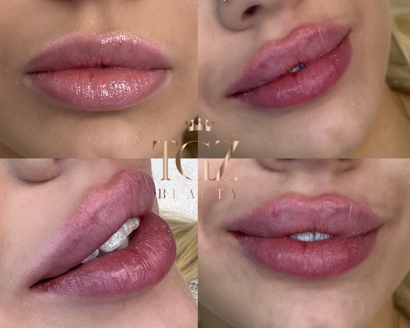 TGZ beauty kuva 4