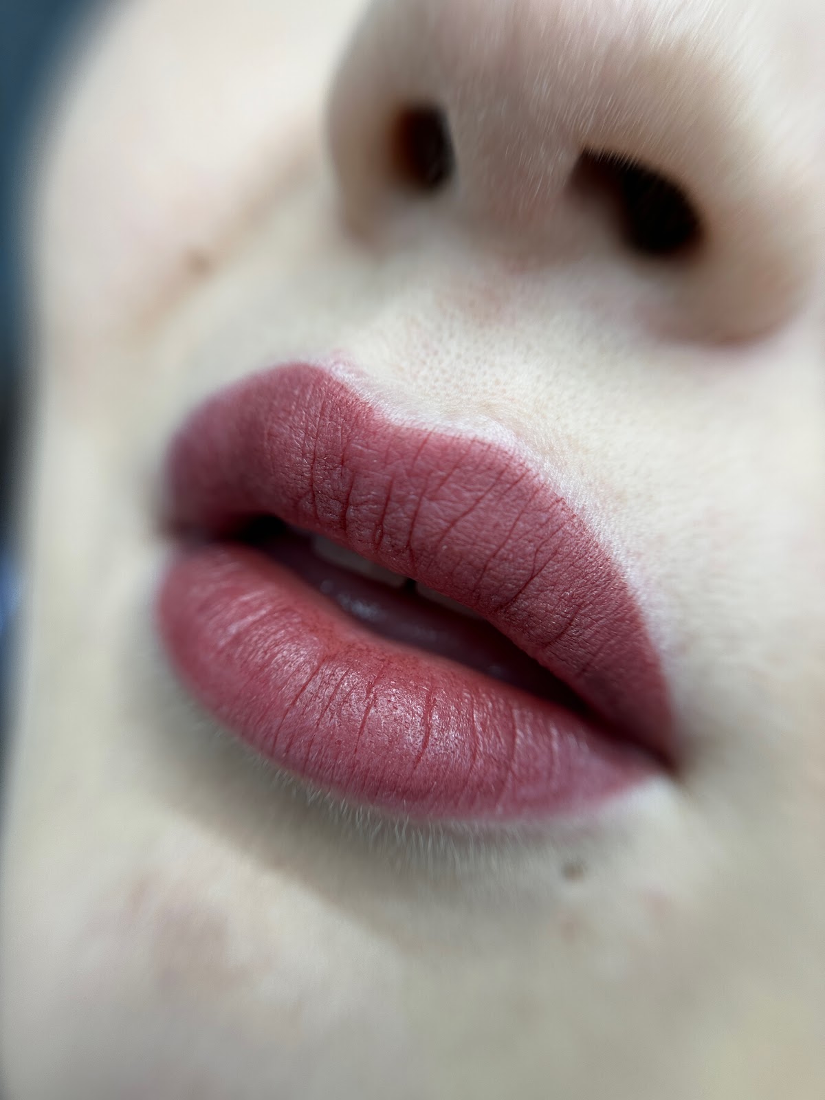 Albina Räsänen Aesthetics Studio kuva 4