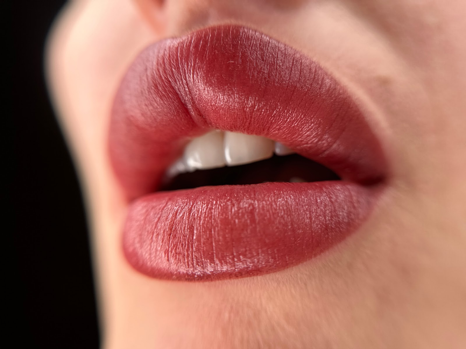 Albina Räsänen Aesthetics Studio kuva 6