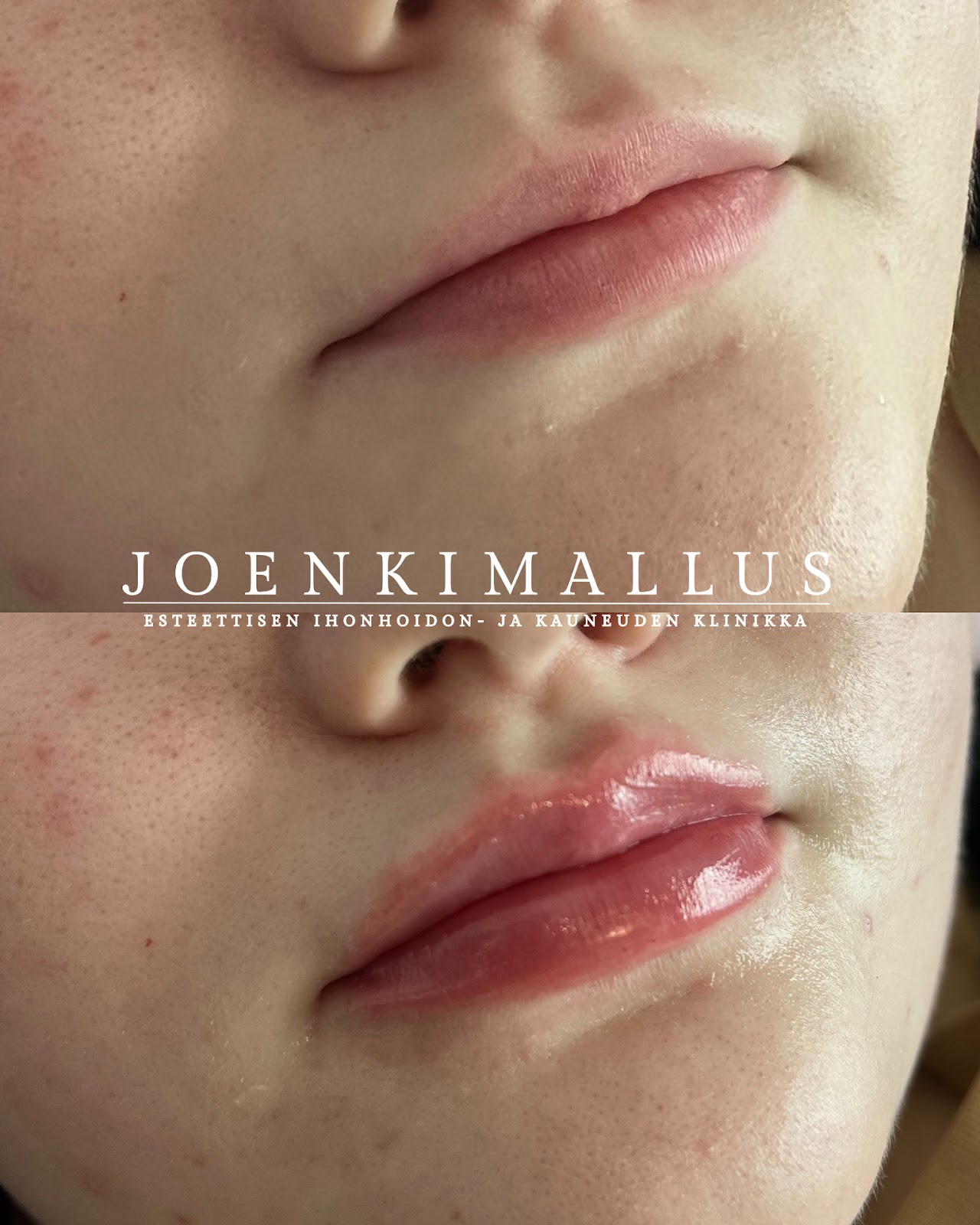 Joenkimallus kuva 6